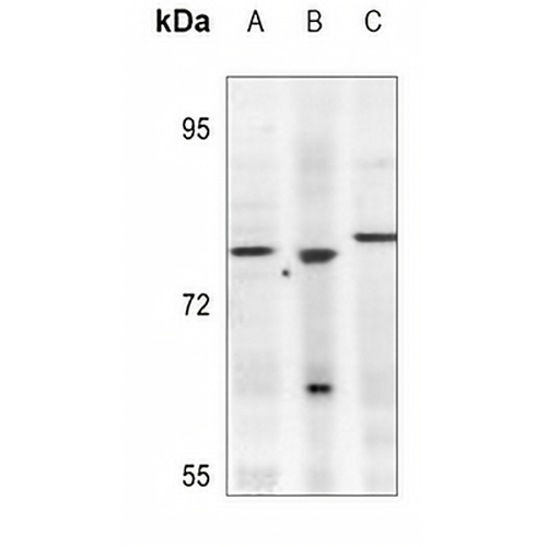 KLHL3 Rabbit Polyclonal Antibody