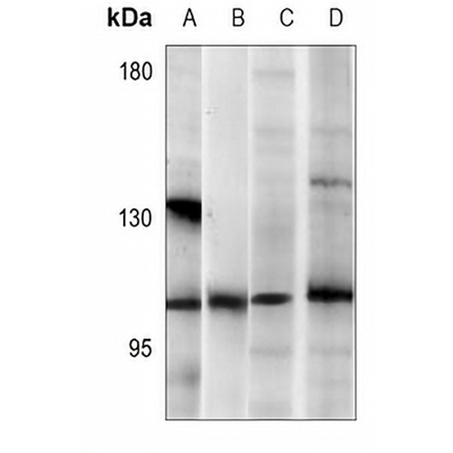CARD10 Rabbit Polyclonal Antibody