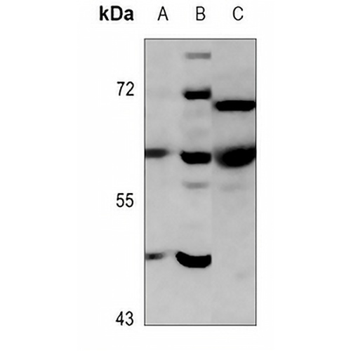 PARP2 Rabbit Polyclonal Antibody