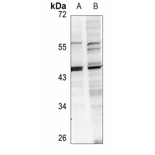 ABHD12 Rabbit Polyclonal Antibody