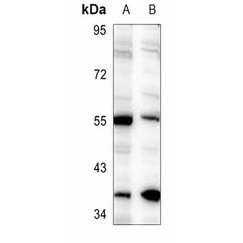 CHRNB1 Rabbit Polyclonal Antibody