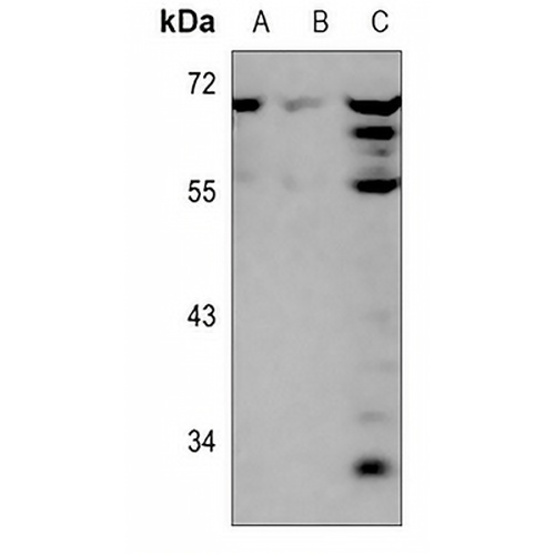 ARFGAP3 Rabbit Polyclonal Antibody