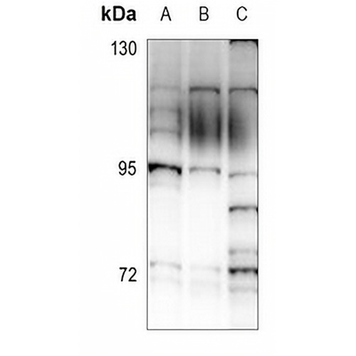 ALS2CR8 Rabbit Polyclonal Antibody