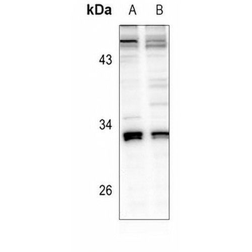 AIG1 Rabbit Polyclonal Antibody