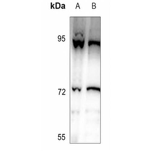 DDX51 Rabbit Polyclonal Antibody
