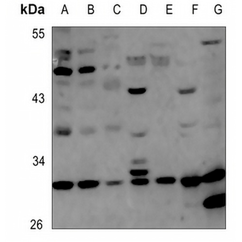 Carbonic Anhydrase 5B Rabbit Polyclonal Antibody