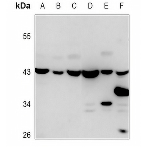 CLN6 Rabbit Polyclonal Antibody