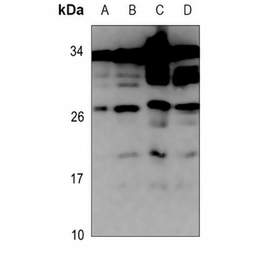 ZNRF1 Rabbit Polyclonal Antibody