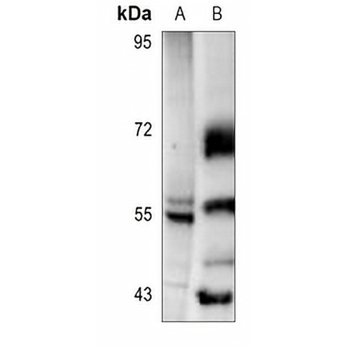 Fibulin 3 Rabbit Polyclonal Antibody
