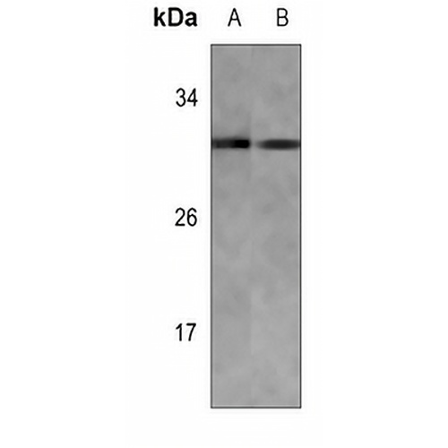 KDELR3 Rabbit Polyclonal Antibody