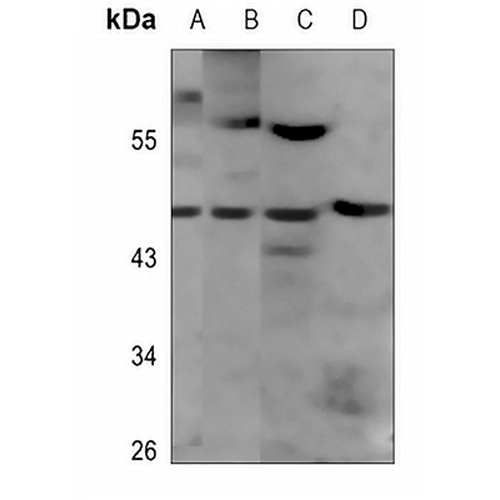 NKX6-1 Rabbit Polyclonal Antibody