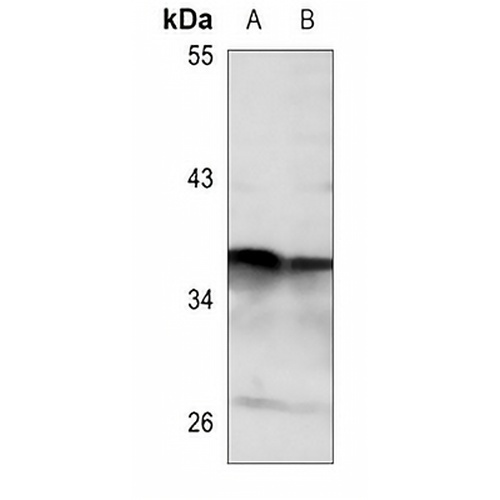LYS5 Rabbit Polyclonal Antibody