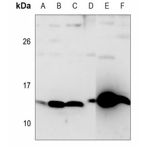 SAA Rabbit Polyclonal Antibody