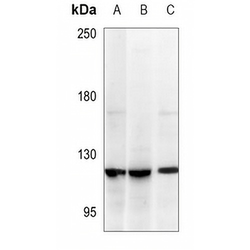 UPF1 Rabbit Polyclonal Antibody