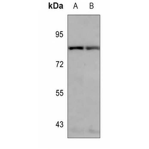 ARHGAP11A Rabbit Polyclonal Antibody