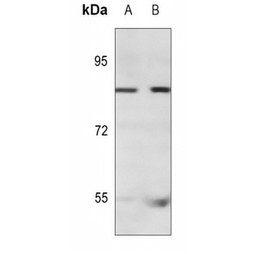 NEK4 Rabbit Polyclonal Antibody
