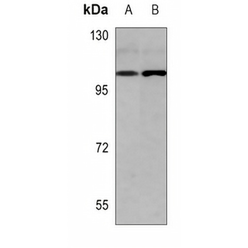 USP13 Rabbit Polyclonal Antibody