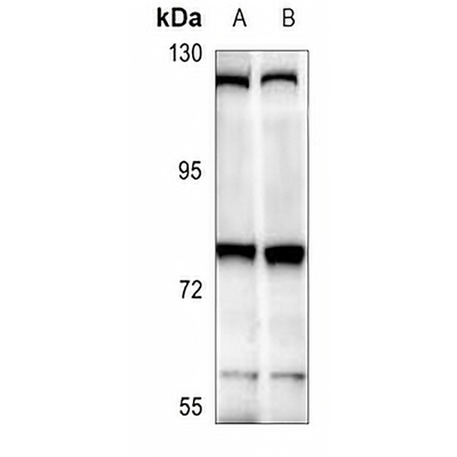 THOC5 Rabbit Polyclonal Antibody
