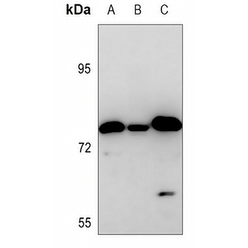 ZNF420 Rabbit Polyclonal Antibody