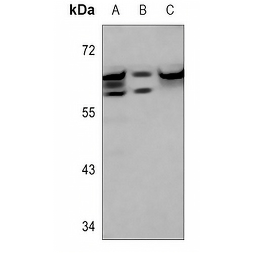 IGF2BP2 Rabbit Polyclonal Antibody