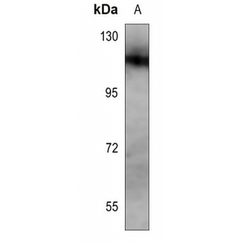 NOTCH1 Rabbit Polyclonal Antibody