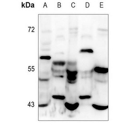 CCR10 Rabbit Polyclonal Antibody