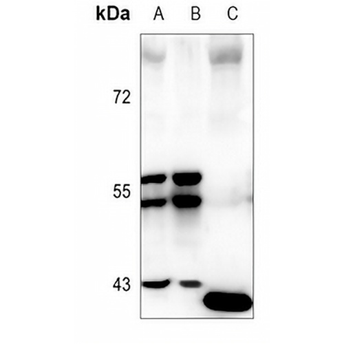 CCR10 Rabbit Polyclonal Antibody