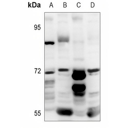 CD126 Rabbit Polyclonal Antibody