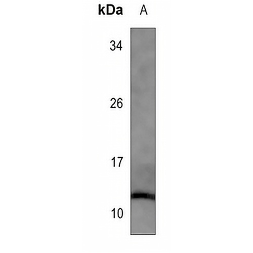 Histone H4 (Acetyl-K91) Rabbit Polyclonal Antibody