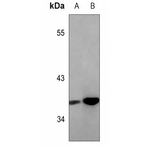 C/EBP alpha Rabbit Polyclonal Antibody