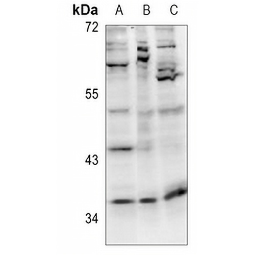 Cyclin D1 Rabbit Polyclonal Antibody