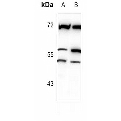 MATK Rabbit Polyclonal Antibody