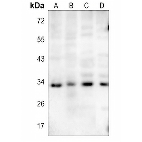 STING (Phospho-S366) Rabbit Polyclonal Antibody