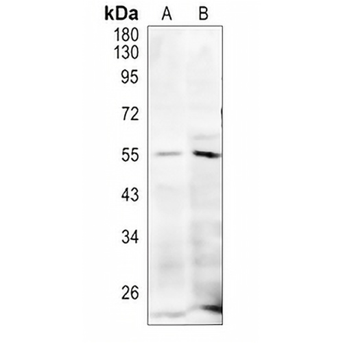 MLKL (Phospho-S345) Rabbit Polyclonal Antibody