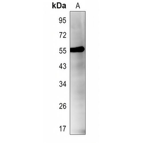 RIPK3 (Phospho-S227) Rabbit Polyclonal Antibody