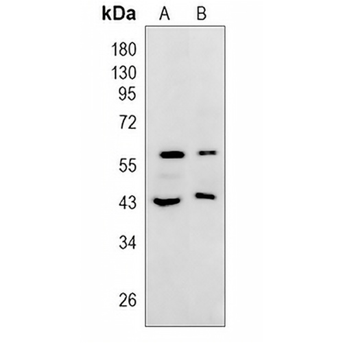 Heparanase Rabbit Polyclonal Antibody