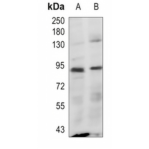 CD97 Rabbit Polyclonal Antibody