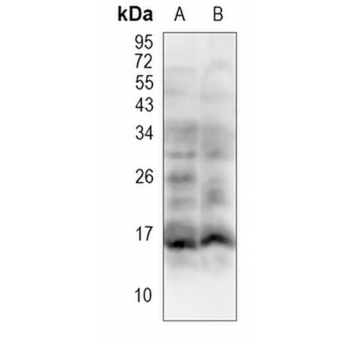 Survivin Rabbit Polyclonal Antibody