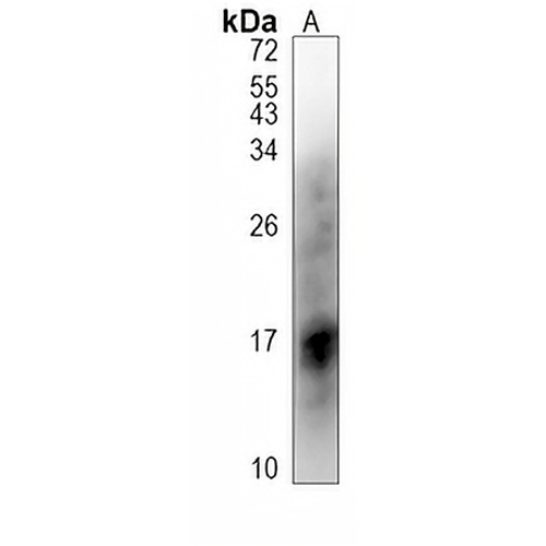 Prothymosin alpha Rabbit Polyclonal Antibody