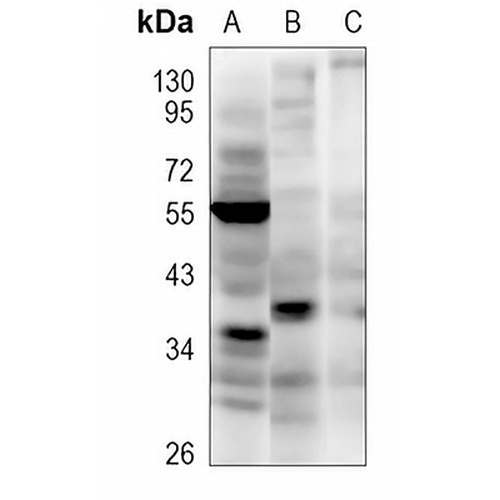 TTC35 Rabbit Polyclonal Antibody