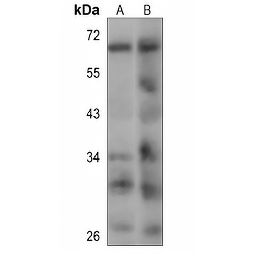MCOLN1 Rabbit Polyclonal Antibody