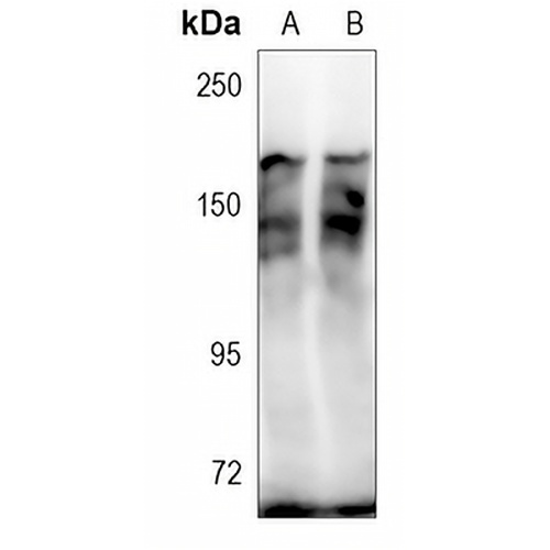 KANK1 Rabbit Polyclonal Antibody