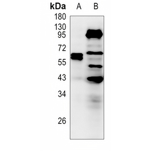 NF-kappaB p65 Rabbit Polyclonal Antibody