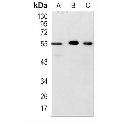 ALK5 Rabbit Polyclonal Antibody