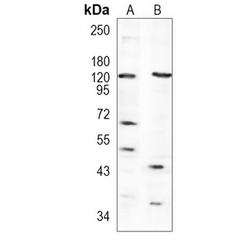 SIRT1 Rabbit Polyclonal Antibody