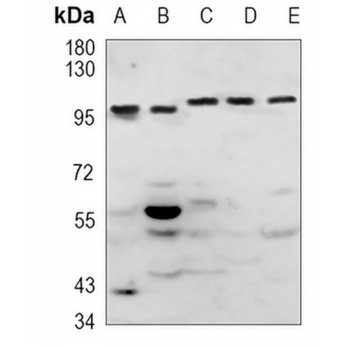 FER (Phospho-Y714) Rabbit Polyclonal Antibody