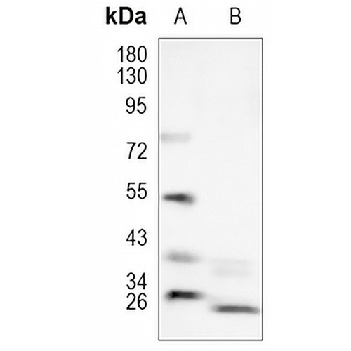 Presenilin 1 (Phospho-S353) Rabbit Polyclonal Antibody