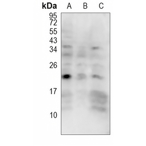 Von Hippel Lindau (Phospho-S68) Rabbit Polyclonal Antibody