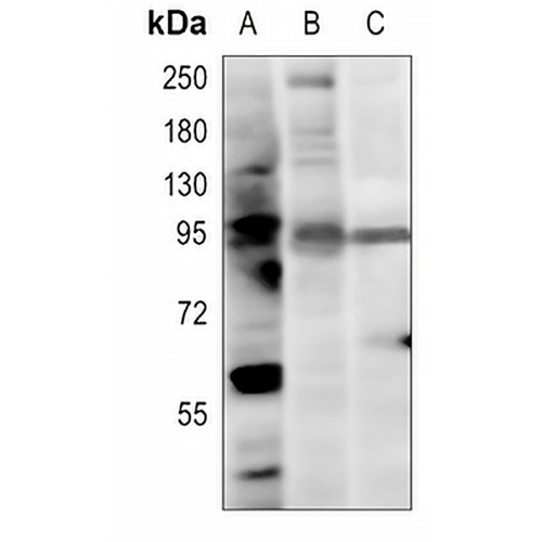 PI3K p85 alpha Rabbit Polyclonal Antibody