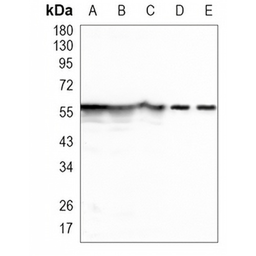 Pyruvate Kinase Rabbit Polyclonal Antibody